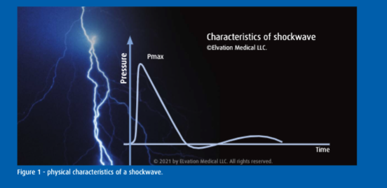 Shockwave FAQs