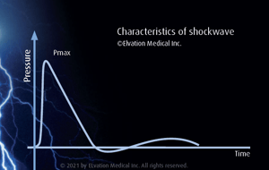 characteristics of shockwave graphic
